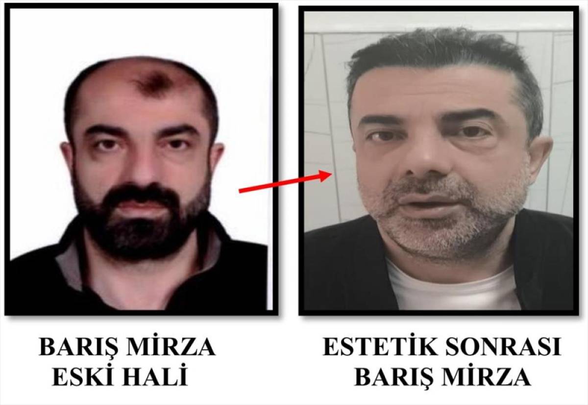 Ameliyat ile y&uuml;z&uuml;n&uuml; değiştiren firari cinayet zanlısı 7 yıl sonra yakalandı
