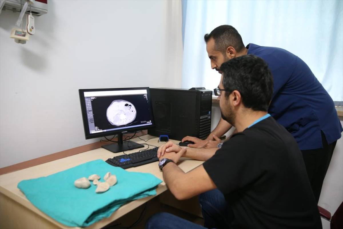 İdrar kanalı ve mesanesinden yarım kilogram ağırlığında 6 taş &ccedil;ıkarıldı