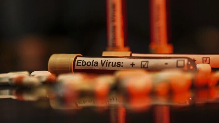 DS&Ouml;, Uganda'da şimdiye kadar 19 Ebola vir&uuml;s&uuml; vakasının g&ouml;r&uuml;ld&uuml;ğ&uuml;n&uuml; bildirdi