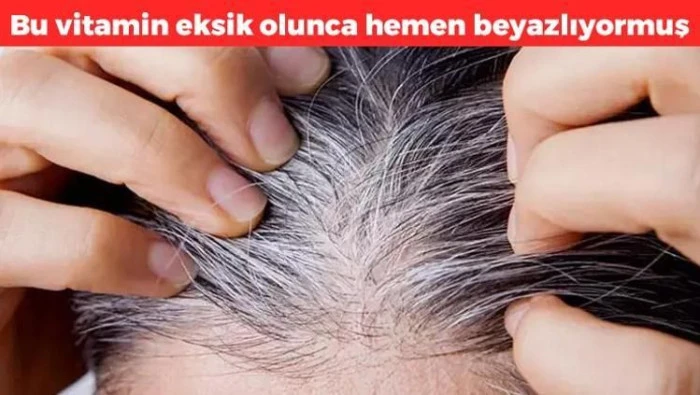 Sa&ccedil; beyazlamasında genetik yapı belirleyici rol oynuyor